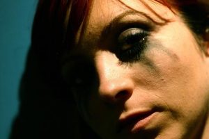 Selvskade eller behovet for at skade sig selv