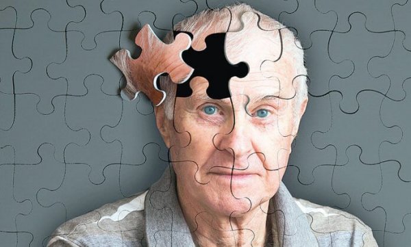 Mands hoved som et puslespil, hvor en brik mangler på grund af alzheimers