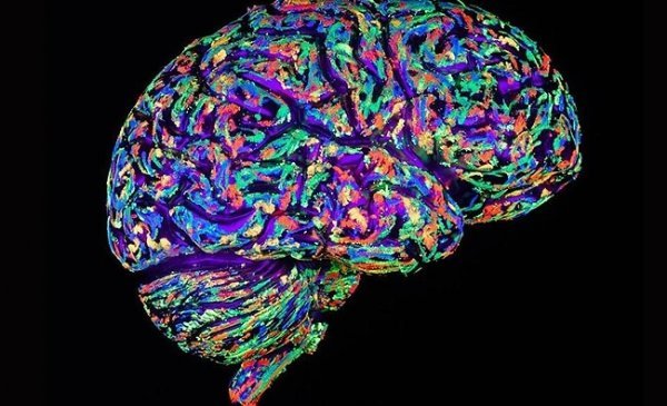 Hjerne i forskellige farver