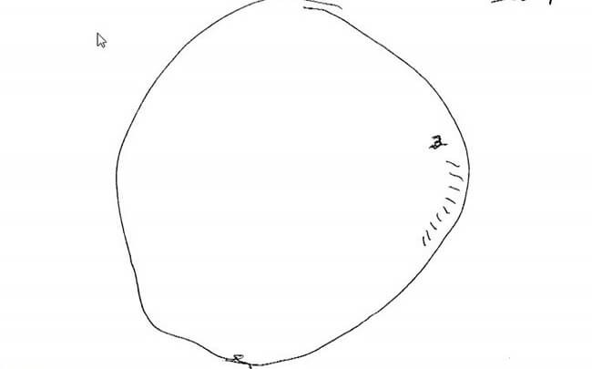 Resultat af urskivetesten