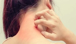 Atopisk dermatitis og stress - hvordan er forholdet?