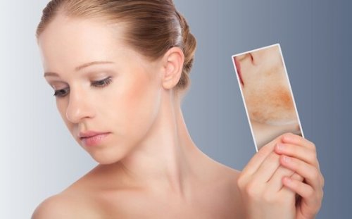 kvinde med billede af atopisk dermatitis