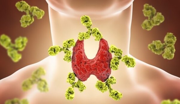 Sygdomme i skjoldbruskkirtlen