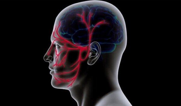 blodkar i hjernen og ansigtet. Trigeminusneuralgi