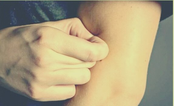 hånd piller i arm. Ekskoriation