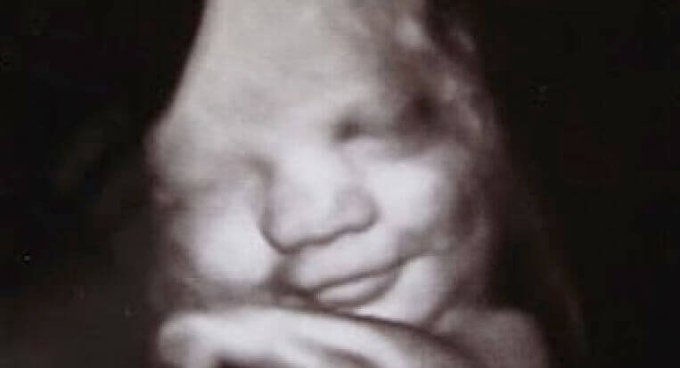 Scanningsbillede af foster i livmoder giver os en idé om, hvad er følelser