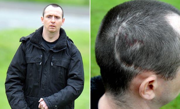 Paul Pugh lider af patologisk latter