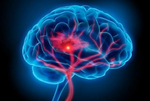 Hjerne i farver, der illustrerer effekten af stress
