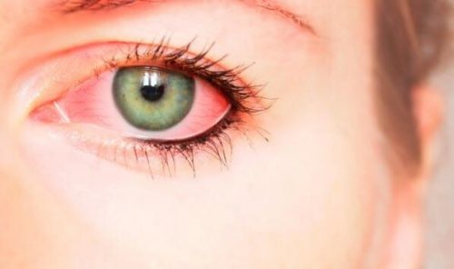 Blodsprængte øjne kan være tegn på psykologisk vold