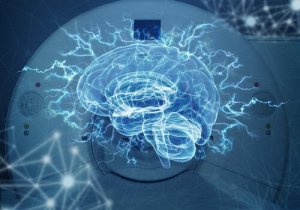 Forskelle mellem CAT-scanning og MRI-scanning