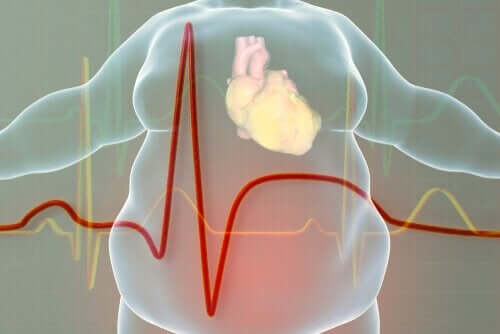 Billede af hjerte med fedt omkring i krop viser et behov for behandling af overvægt