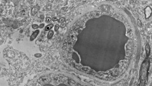 Hjernens mikrobiom: Tarmbakterier i hjernen