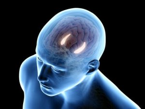 Læs alt om interkranielt aneurisme