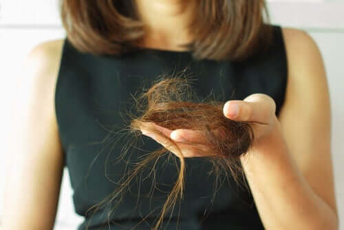 Kvinde med en klump hår i hånden illustrerer alopecia hos kvinder