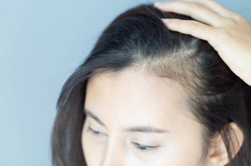 De psykologiske konsekvenser af alopecia hos kvinder
