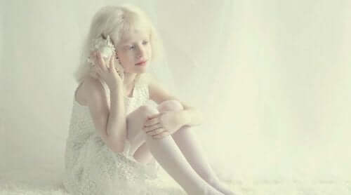 Lille pige, der skal leve med albinisme
