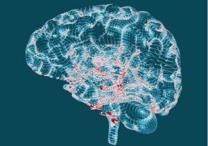 Huntingtons sygdom - karakteristika og kendetegn