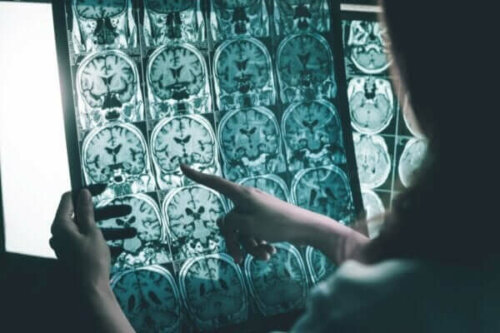 Stimulation af hjernebølger til personer med Alzheimers