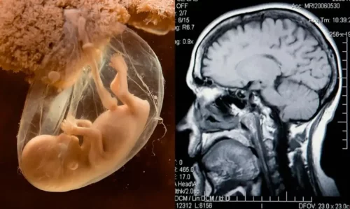 Hjerne og foster ses side om side