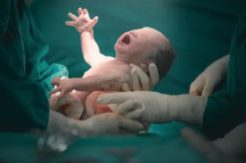 Nyfødt baby under en fødsel