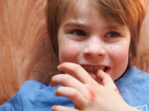 Stimming: Selvstimulerende adfærd i autisme