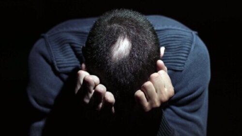 Forbindelsen mellem alopecia areata og stress